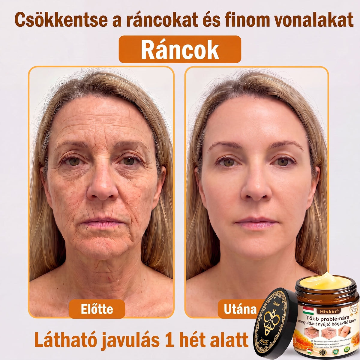 🐝🔥𝐇𝐈𝐒𝐊𝐈𝐍® 𝐌𝐮𝐥𝐭𝐢-𝐂𝐨𝐧𝐜𝐞𝐫𝐧 𝐛ő𝐫𝐫𝐞𝐠𝐞𝐧𝐞𝐫á𝐥ó 𝐤𝐫é𝐦✨ (Egyetlen hatékony krém a gyulladás, a szárazság, az öregedés, a pigmentáció és a látható bőrkárosodás kezelésére.)