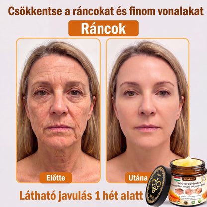 🐝🔥𝐇𝐈𝐒𝐊𝐈𝐍® 𝐌𝐮𝐥𝐭𝐢-𝐂𝐨𝐧𝐜𝐞𝐫𝐧 𝐛ő𝐫𝐫𝐞𝐠𝐞𝐧𝐞𝐫á𝐥ó 𝐤𝐫é𝐦✨ (Egyetlen hatékony krém a gyulladás, a szárazság, az öregedés, a pigmentáció és a látható bőrkárosodás kezelésére.)