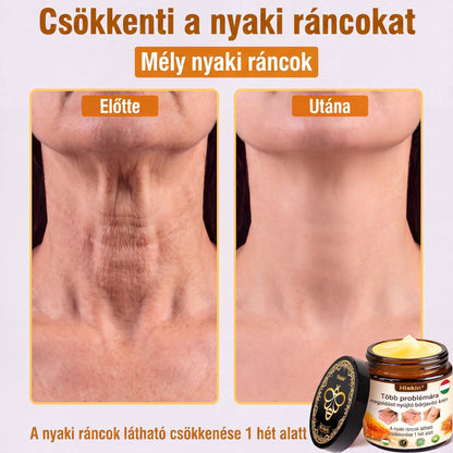 🐝🔥𝐇𝐈𝐒𝐊𝐈𝐍® 𝐌𝐮𝐥𝐭𝐢-𝐂𝐨𝐧𝐜𝐞𝐫𝐧 𝐛ő𝐫𝐫𝐞𝐠𝐞𝐧𝐞𝐫á𝐥ó 𝐤𝐫é𝐦✨ (Egyetlen hatékony krém a gyulladás, a szárazság, az öregedés, a pigmentáció és a látható bőrkárosodás kezelésére.)