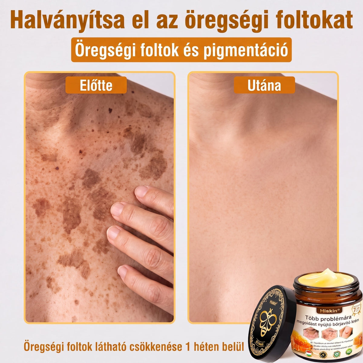🐝🔥𝐇𝐈𝐒𝐊𝐈𝐍® 𝐌𝐮𝐥𝐭𝐢-𝐂𝐨𝐧𝐜𝐞𝐫𝐧 𝐛ő𝐫𝐫𝐞𝐠𝐞𝐧𝐞𝐫á𝐥ó 𝐤𝐫é𝐦✨ (Egyetlen hatékony krém a gyulladás, a szárazság, az öregedés, a pigmentáció és a látható bőrkárosodás kezelésére.)