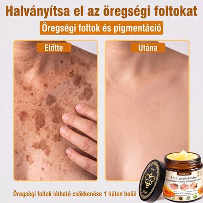 🐝🔥𝐇𝐈𝐒𝐊𝐈𝐍® 𝐌𝐮𝐥𝐭𝐢-𝐂𝐨𝐧𝐜𝐞𝐫𝐧 𝐛ő𝐫𝐫𝐞𝐠𝐞𝐧𝐞𝐫á𝐥ó 𝐤𝐫é𝐦✨ (Egyetlen hatékony krém a gyulladás, a szárazság, az öregedés, a pigmentáció és a látható bőrkárosodás kezelésére.)