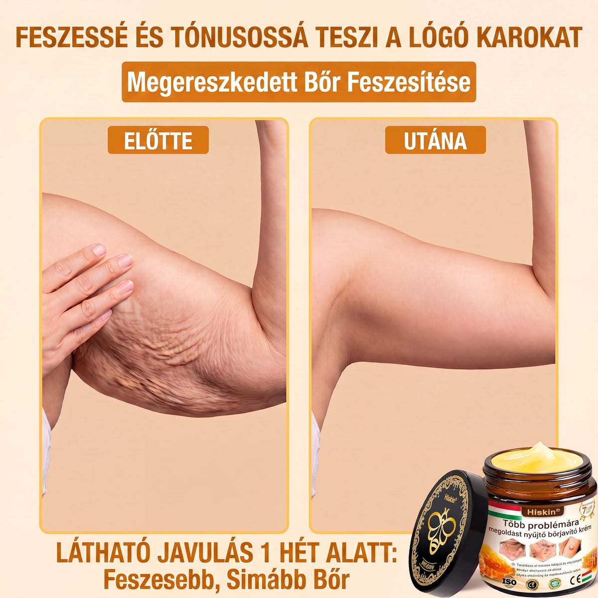🐝🔥𝐇𝐈𝐒𝐊𝐈𝐍® 𝐌𝐮𝐥𝐭𝐢-𝐂𝐨𝐧𝐜𝐞𝐫𝐧 𝐛ő𝐫𝐫𝐞𝐠𝐞𝐧𝐞𝐫á𝐥ó 𝐤𝐫é𝐦✨ (Egyetlen hatékony krém a gyulladás, a szárazság, az öregedés, a pigmentáció és a látható bőrkárosodás kezelésére.)