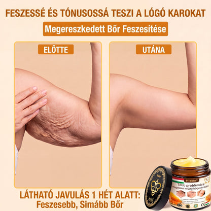 🐝🔥𝐇𝐈𝐒𝐊𝐈𝐍® 𝐌𝐮𝐥𝐭𝐢-𝐂𝐨𝐧𝐜𝐞𝐫𝐧 𝐛ő𝐫𝐫𝐞𝐠𝐞𝐧𝐞𝐫á𝐥ó 𝐤𝐫é𝐦✨ (Egyetlen hatékony krém a gyulladás, a szárazság, az öregedés, a pigmentáció és a látható bőrkárosodás kezelésére.)