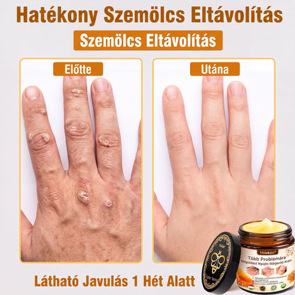 🐝🔥𝐇𝐈𝐒𝐊𝐈𝐍® 𝐌𝐮𝐥𝐭𝐢-𝐂𝐨𝐧𝐜𝐞𝐫𝐧 𝐛ő𝐫𝐫𝐞𝐠𝐞𝐧𝐞𝐫á𝐥ó 𝐤𝐫é𝐦✨ (Egyetlen hatékony krém a gyulladás, a szárazság, az öregedés, a pigmentáció és a látható bőrkárosodás kezelésére.)